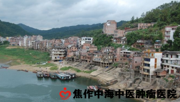 广西苍梧县鼻咽癌