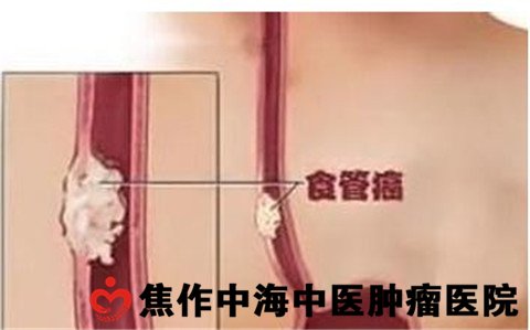 1552464126237538