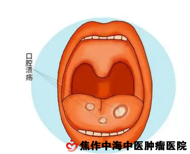 它并非某种病原体(细菌,病毒,立克次体,螺旋体,寄生虫等)引起的.