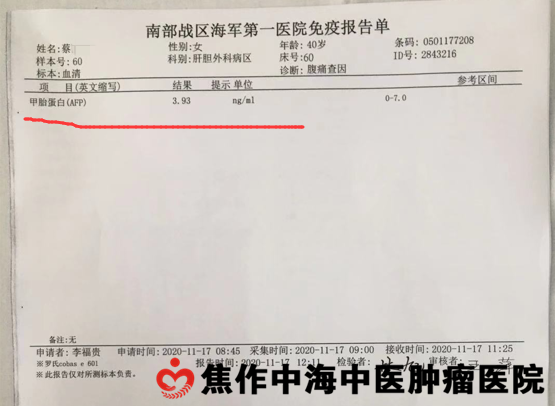 甲胎蛋白报告单