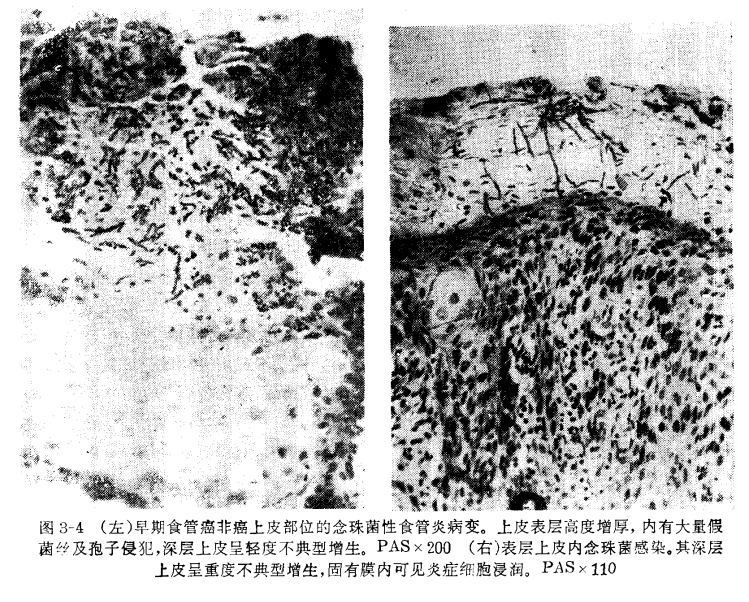 QQ截图20221213152749.png