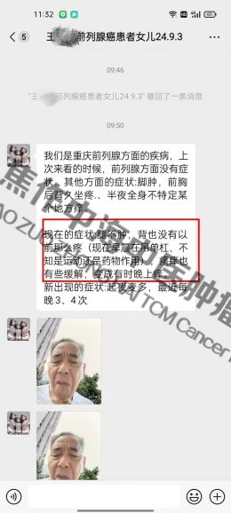 前列腺癌王德生.jpg