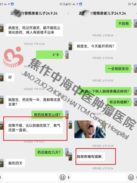 食道癌孟庆瑞.jpg