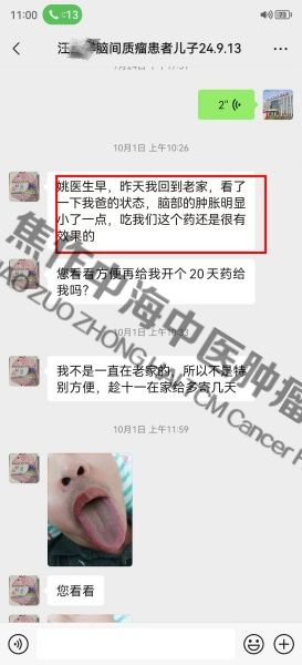 脑瘤汪土洋.jpg