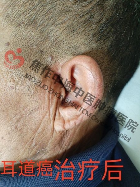 李合钦3.jpg