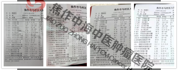 白血病李战荣8.png