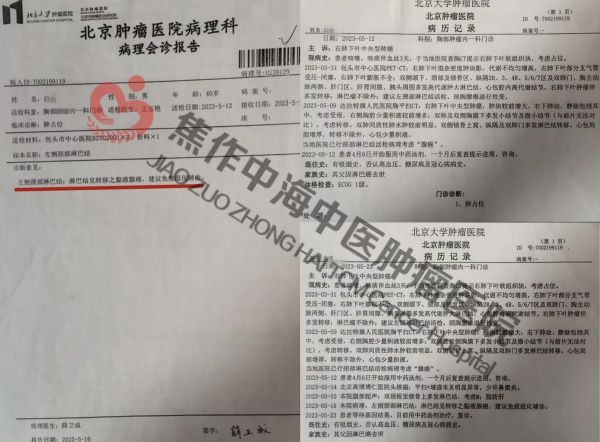 肺癌白光10.jpg
