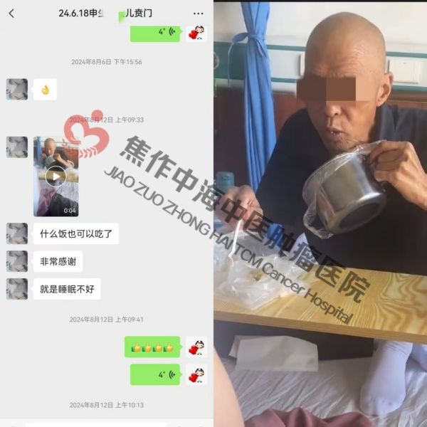 贲门癌申生俊2.jpg