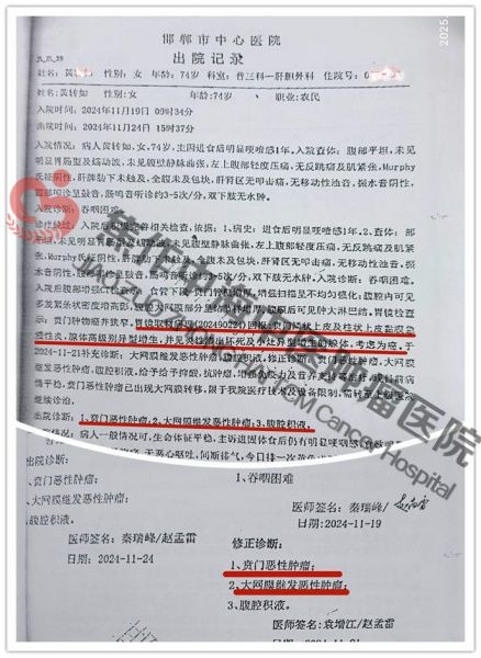 贲门癌黄转如1.jpg