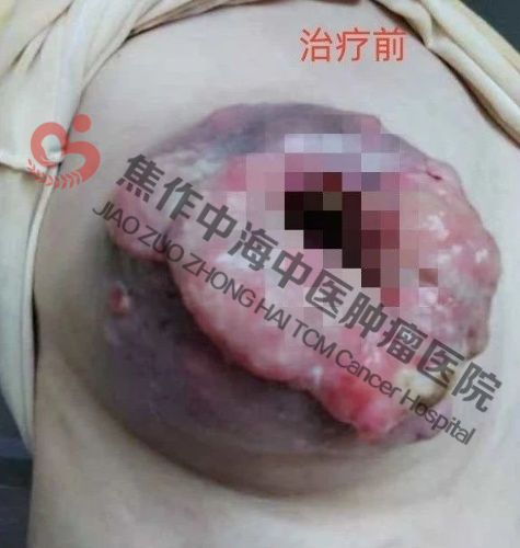 邱慧红1.jpg
