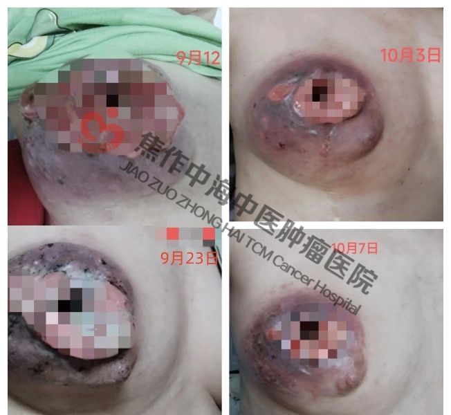 邱慧红2.jpg