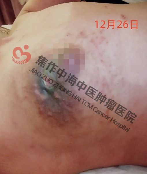 邱慧红3.jpg