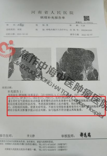 肺癌武模正2.jpg