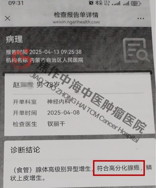 食道癌赵润拴2.jpg