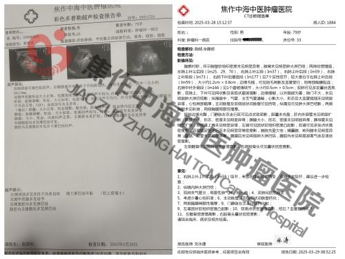 肺癌唐家齐2.jpg