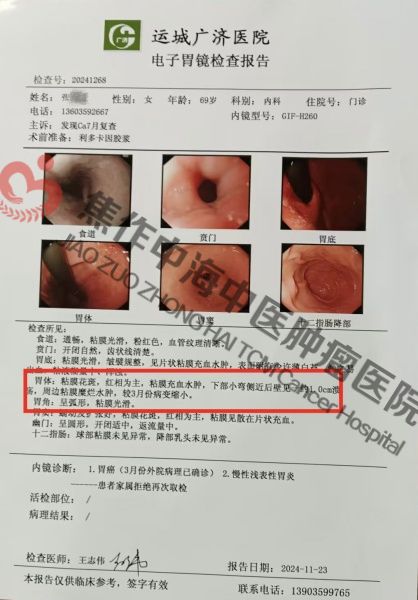 胃癌张秀苗2.jpg