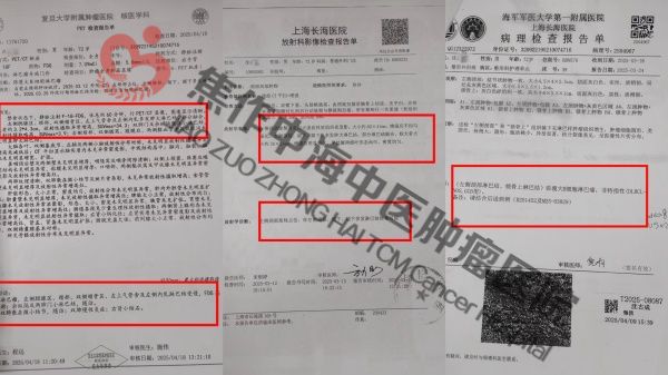 淋巴瘤沈古成2.jpg