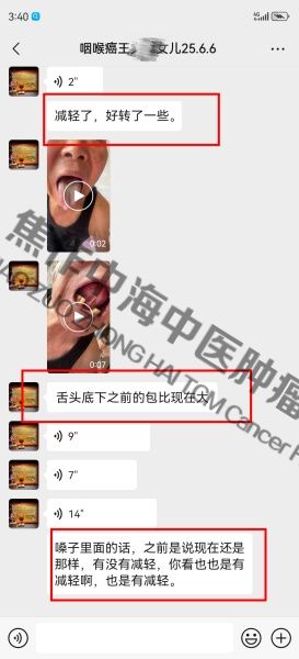 咽喉癌王文章.jpg