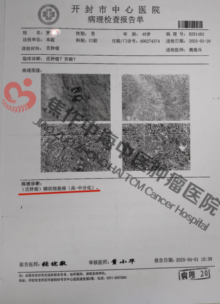 舌癌罗志伟1.png