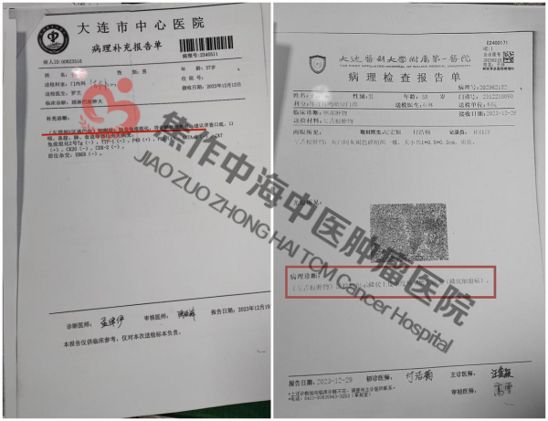 舌癌于洋1.png