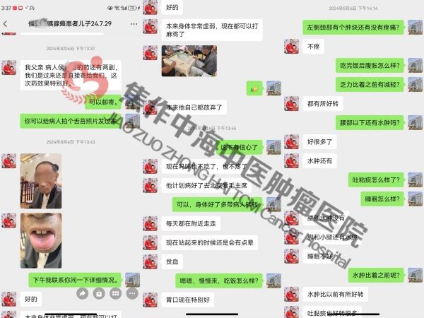 胰腺癌侯钦玉.jpg