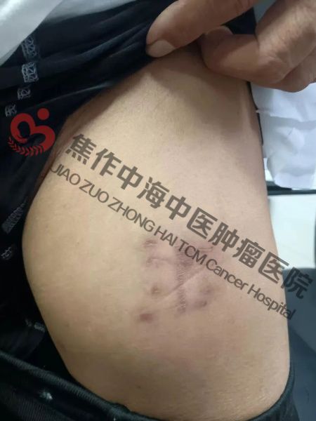 肉瘤刘大爷2.jpg