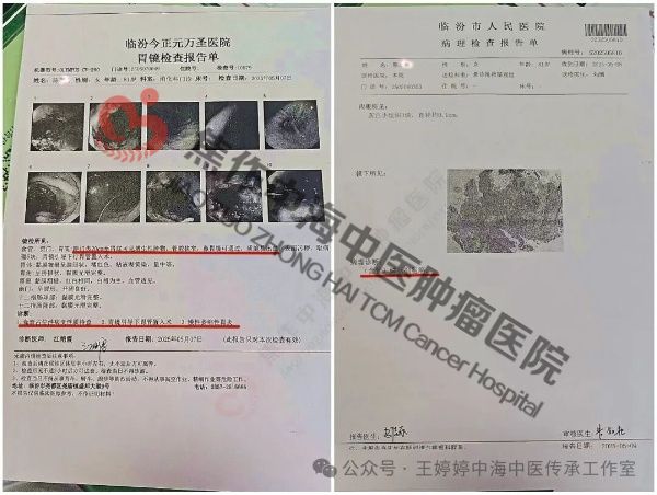 食道癌陈1.jpg