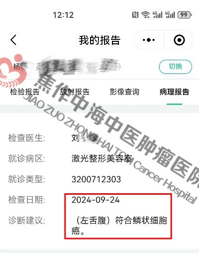 1758528846240667.jpg 舌癌杨林1.jpg