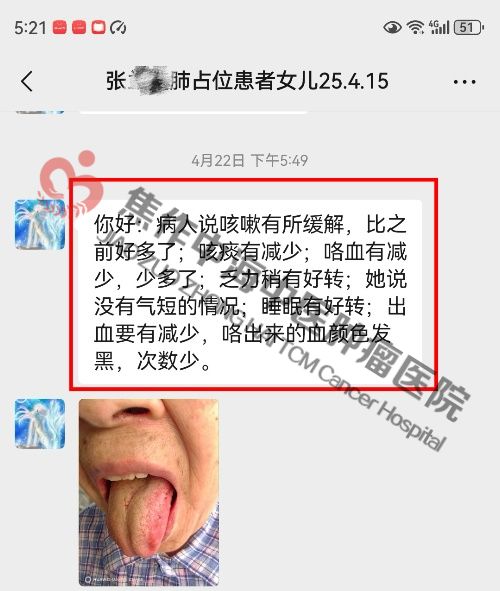 肺癌张兰英.jpg