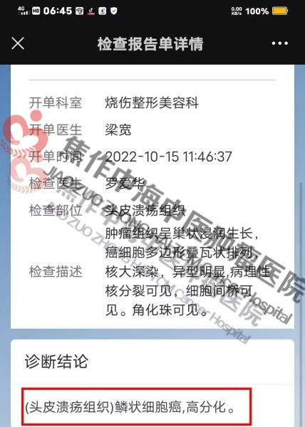 头皮癌萧秀珍1.jpg
