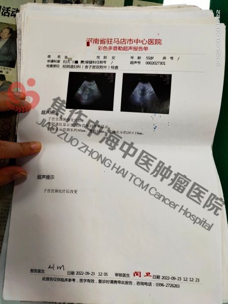 宫颈癌张霞2.jpg