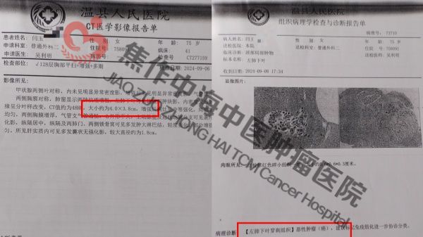 1767165225466000.jpg 肺癌闫玉青1.jpg