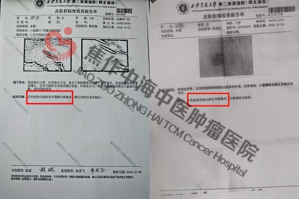 1768206877915509.jpg 面部癌王月凤3.jpg