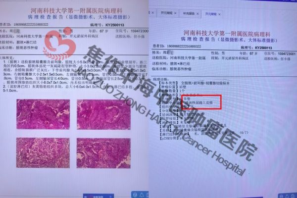 1772269551384604.jpg 膀胱癌周建设1.jpg