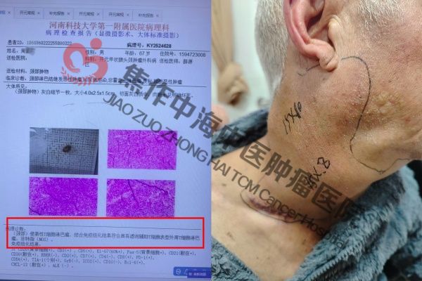 1772269572947231.jpg 膀胱癌周建设2.jpg