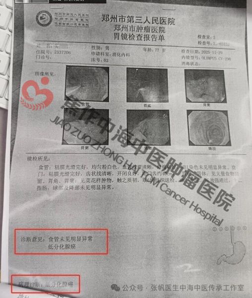 1774491428936758.jpg 食道癌买英朝1.jpg