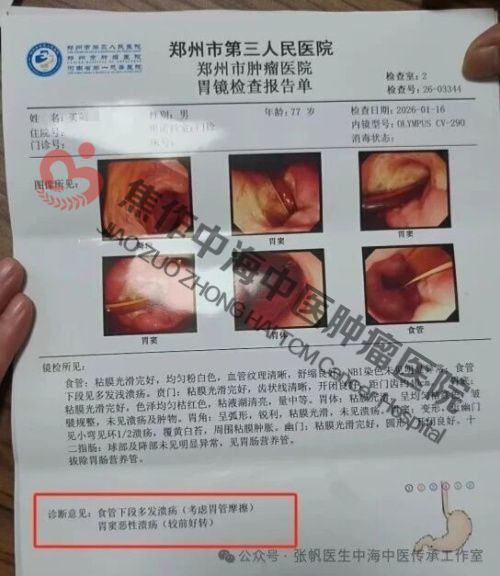 1774491445525083.jpg 食道癌买英朝2.jpg