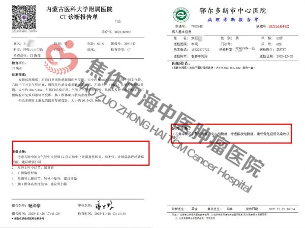 1774579674412890.jpg 肺癌刘连生1.jpg