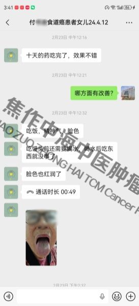 1775614299943789.jpg 食道癌付书连.jpg