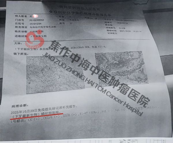 牙龈癌龙文程1.jpg