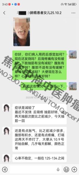 1776136103802980.jpg 肺癌马纪更.jpg