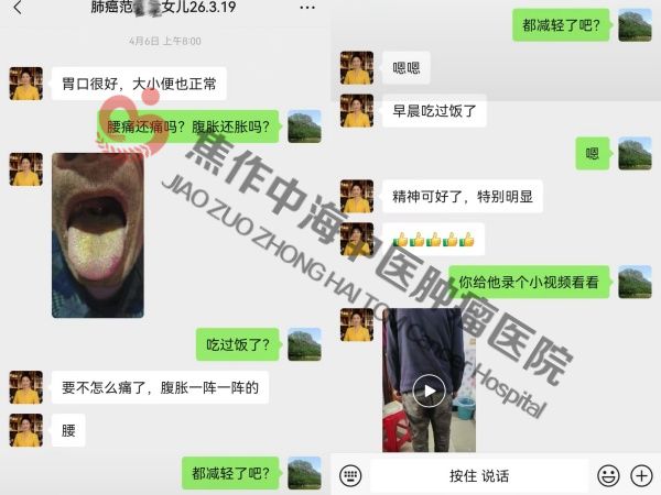 肺癌范金全.jpg