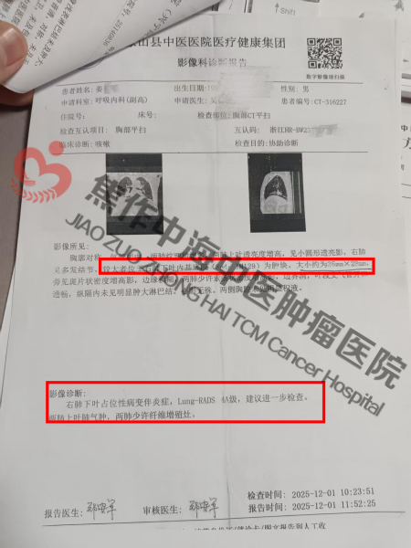 1779089674207808.png 肺癌姜云飞1.png