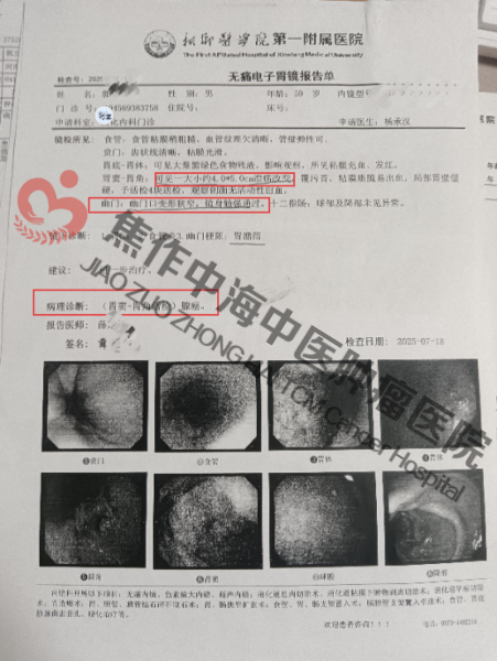 1780039720794726.png 胃癌郭立成1.png