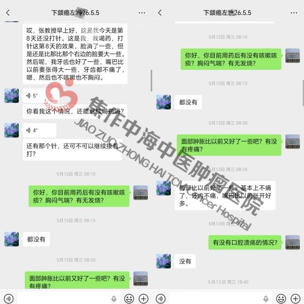 下颌癌左娅.jpg