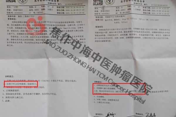 肺癌王趁2.jpg