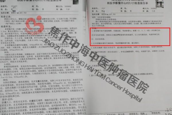 1780998540742074.jpg 食道癌李金兴2.jpg