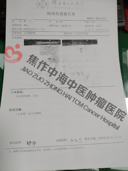 1780998896633168.jpg 舌癌李祥庆1.jpg