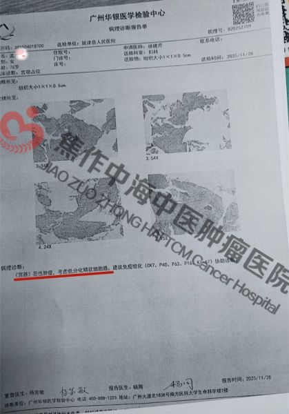 宫颈癌孟凡英2.jpg
