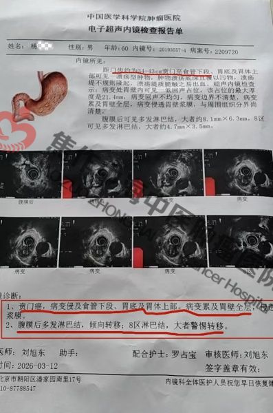 1784604174729715.jpg 贲门癌杨根旺2.jpg